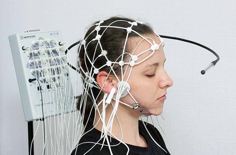 EEG (elektroensefalografiya)